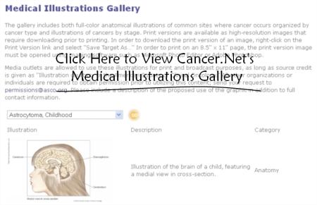 illustrations (68K)